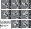 http://www.scielo.br/img/revistas/rb/v39n5/en_a08fig02.gif